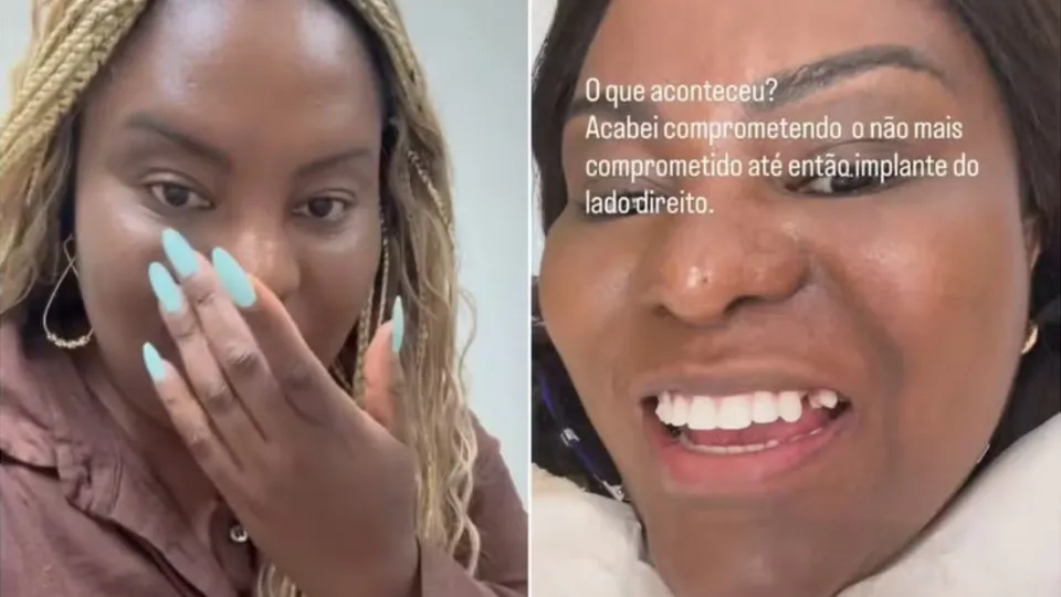 Ex-Rouge enfrenta imprevisto dental antes do Carnaval